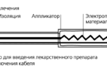Процедуры физиотерапии при простатите